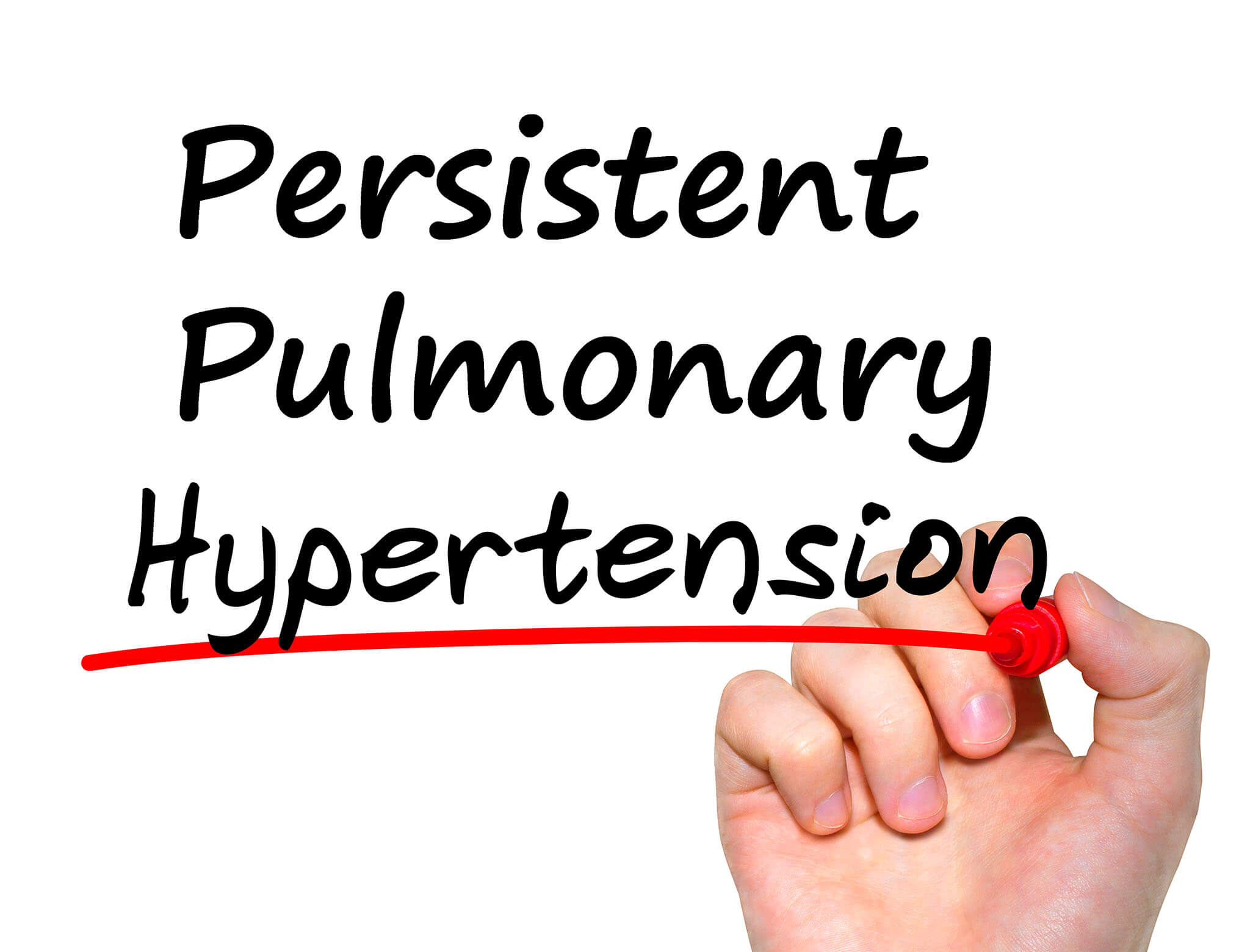 Persistent Pulmonary Hypertension illustration
