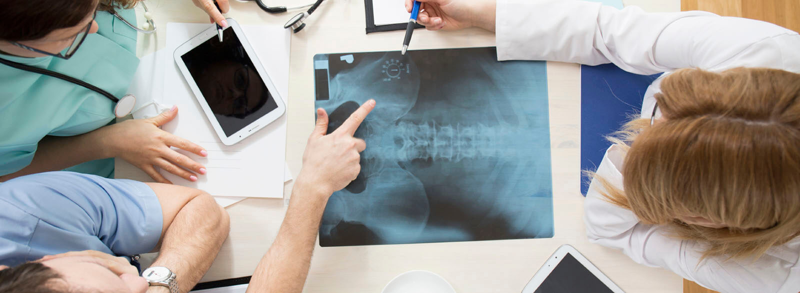 Doctors reviewing x-ray of a hip needing replacement surgery.